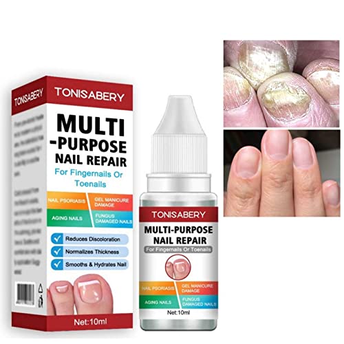 Fungal Nail Treatment,Nail Fungus Treatment For Toenail,Toe Nail Fungal Treatment,Ingrown Toenail Treatment,Toenail Fungus Treatment For Toenails