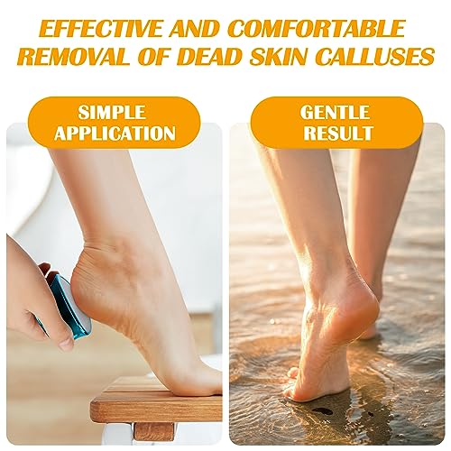 A3A ACADGQ Foot File - Double-Sided Nano Glass Callus Remover & Crystal Hair Eraser 2-in-1, Safe & Quick Callus Remover for Feet, Epilator for Wo