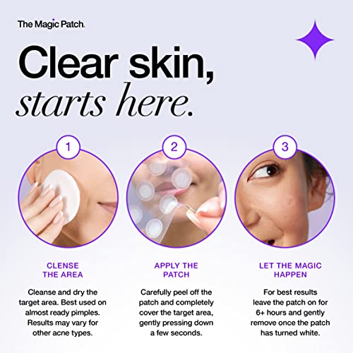 The Magic Patch Acne Patches - Pack of 30 Translucent Hydrocolloid Pimple Patch Spot Treatment Stickers for Face and Body - Fast-Acting, Vegan &