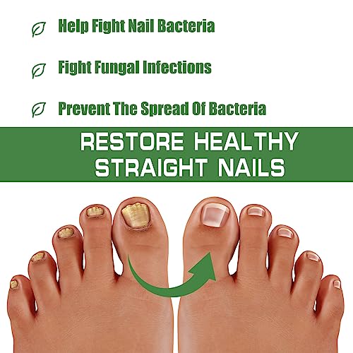 Fungal Nail Treatment, Nail Repair Kit For Broken Natural Nails, Extra Strong Fungal Nail Treatment For Toenails And Fingernail, Ingrown Toenail