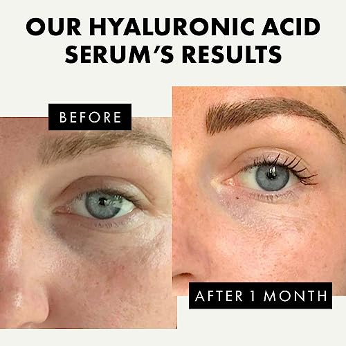 Pure Hyaluronic Acid Face Serum - 2.5% Hyaluronic Serum + 3% B5, Anti Wrinkle + Anti Aging Serum for Face with Vitamin C & E, Aloe - Antiaging Hy