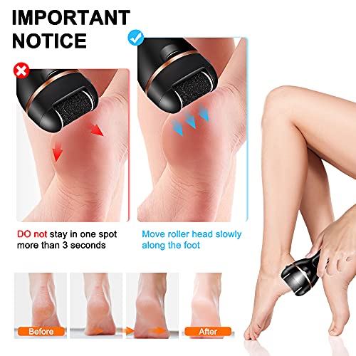 Electric Foot File, Ratukall Hard Skin Remover, Rechargeable Waterproof Callus Remover Feet Care Kit, Professional Pedicure Tools Set with Storag