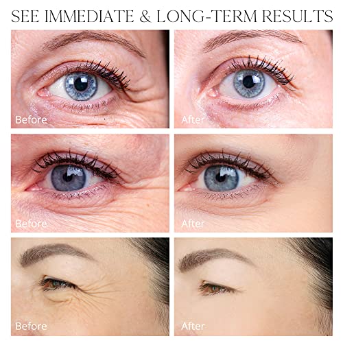 Retinol Stick, Retinol Face Cream, Under Eye Cream Anti Aging, Brightening Balm Reduces Fine Lines and Dark Circles, Visible Results in 3-4 Weeks