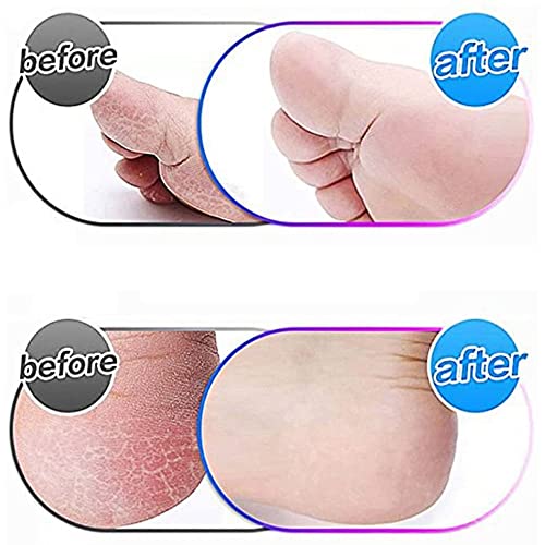 Hsthe Sea 4 Pack Extra Coarse Mineral Replacement Rollers Mineral Replacement Rolls for Emjoi Micro Pedi Callus Remover Refill Rollers (grey)