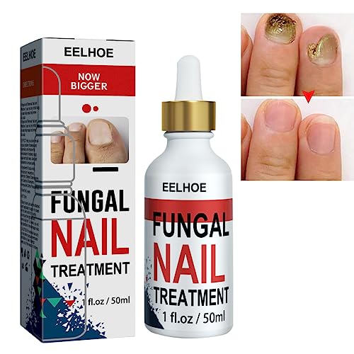 Fungal Nail Treatment for Toenails Extra Strong,50ML Nail Fungus Treatment for Toenail,Ingrown Toenail Fungus Treatment,Anti Severe Fungal Nail T