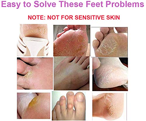 BOMPOW Foot Peel Mask, Exfoliating Socks Foot Mask, Peel Off Dry Dead Cracked Hard Skin in 3-7 Days, Lavender Scented Exfoliating Foot Socks, 2 P