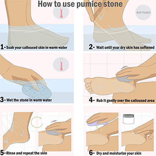 Pumice Stone for Feet 2 PCS Set_Foot Care Natural Pummice Stones for Dead Hard Skin_Foot Scrubber Calluses Removes_Gently Exfoliates Skin_Softer