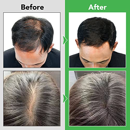 Rosemary Shampoo, 300ml Rosemary Shampoo for Cleanse Hair, Helps Improve Hair Growth, Moisturize & Soften Hair, Hair Care Shampoo for Hair Loss,