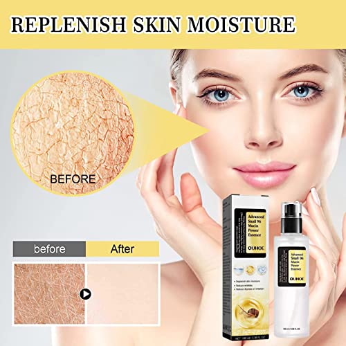 Fullcube Advanced Snail 96 Mucin Power Essence -Snail Secretion Filtrate 96% Revitalize and Moisturize with Reduce Wrinkles and Irritation,Skin R