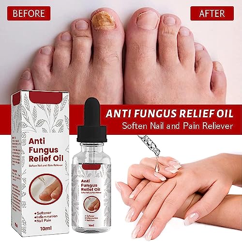 Nail Onychomycosis Rapid Relief Oil,Onychomycosis Rapid Relief Oil,Onychomycosis Nail Treatment Oil,Toenail Repair for Damaged Nails,Collagen Boo