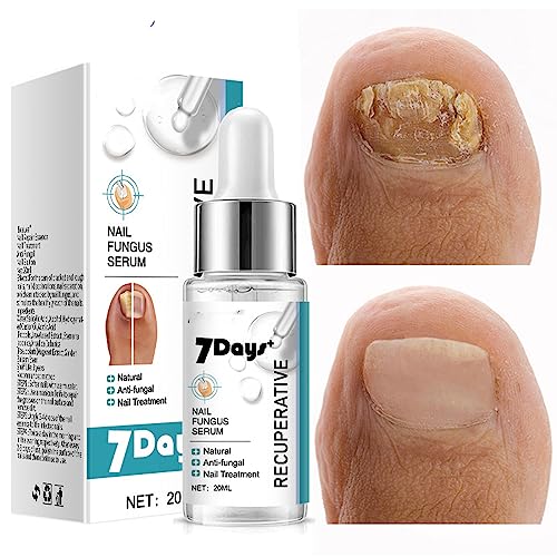 Fungal Nail Treatment For Toenails - Extra Strong Extra Strong Nail Fungus Treatment for Toenail - Fingernail & Toenail Care Solution - Fix & Ren