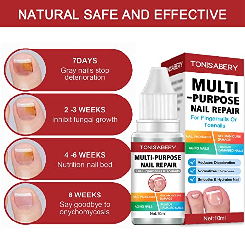 Fungal Nail Treatment,Nail Fungus Treatment For Toenail,Toe Nail Fungal Treatment,Toenail Fungus Treatment,Fungal Nail Treatment For Toenails Ext