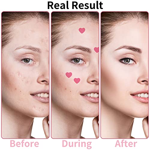 Fuyamp 54 Pcs Pimple Patches, Pink Love Heart Acne Spot Patch with Niacinamide and Hyaluronic acid, Moisturizing, Blemish Spot, Fast Healing Acne