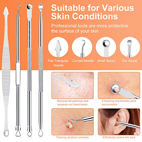 Blackhead Remover Tool Kit, IUMAKEVP 15 PCS Professional Stainless Steel Pimple Popper Comedone Extractor Tools for Removing Pimple, Blackheads,