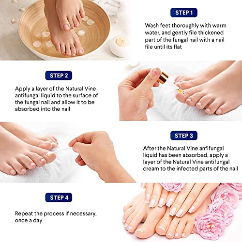 Fungal Nail Treatment, Fungal Nail Treatment for Toenail Extra Strong, Nail Fungus TreatmentforToenail, Toe Nail Fungus Treatment, Toenail Fungus