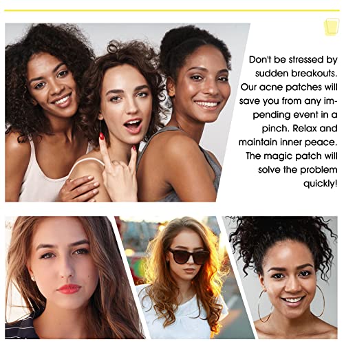 Hydrocolloid Acne Patch, Large Pimple Patch Spot Control Cover, Acne Patch for Covering Large Breakouts, Spot Patch, Pimple Stickers for Body, Ch