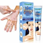 GFOUK Vitiligo Therapy Cream,for Reduce White Spots and Improve Skin Pigmentation (2pcs)