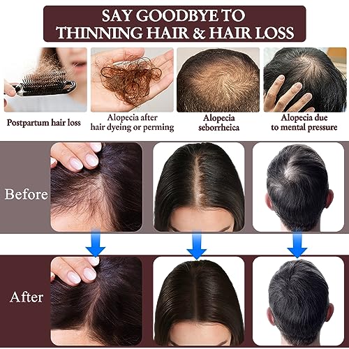 BEHAPRO Rosemary Oil Hair Growth,w/Hair Growth Oil Serum,Hair Growth Shampoo,Rosemary Oil Biotin Castor Oil & Argan Oil Hair Loss Treatment Hair