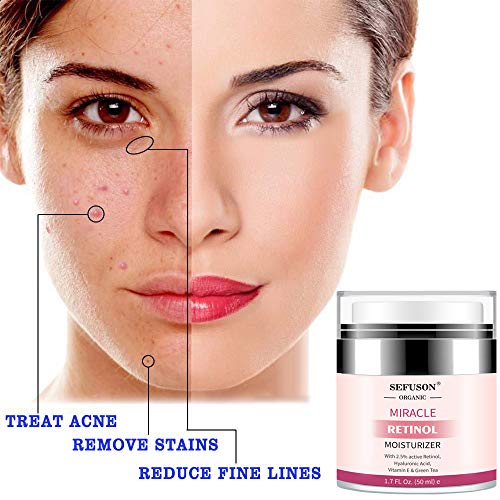 Retinol Moisturizer Cream,For Face&Eye Area Anti Aging Wrinkles & Acne & Fine Lines,with Vitamin E&Hyaluronic Acid & Jojoba Oil.Best Night&Day Fa