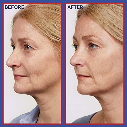 L'Oreal Paris Pure Retinol Serum, Revitalift Laser Deep Anti-Wrinkle Retinol Night Serum For Face [Revitalift Laser Retinol Serum 30ml + x3 Hydra