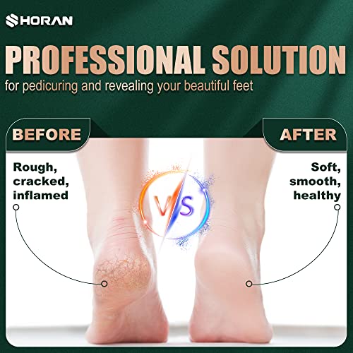 SHORAN Electric Foot File Feet Hard Skin Remover, Professional Callus Remover Foot Grinder Pedicure Foot Care Set for Dead Skin Dry Skin, USB Rec