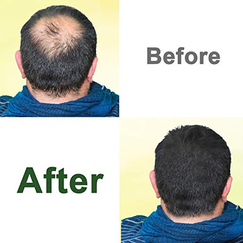 Castor Oil,2 Packs w/Free Lash&Brow Brushes&E-Book,100% Pure Hair Tonic Oil for Eyebrow Lash Eyelash Beard Growth Serum Dry Hair Skin Care Essent