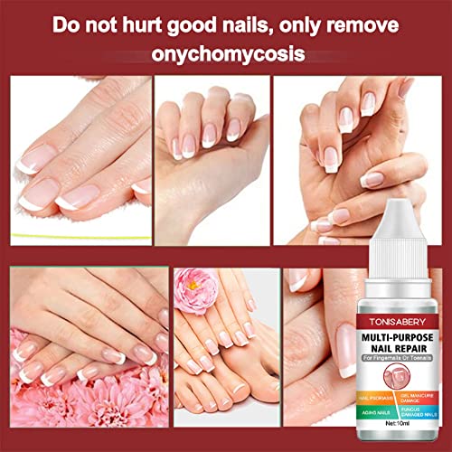 Fungal Nail Treatment,Nail Fungus Treatment For Toenail,Toe Nail Fungal Treatment,Ingrown Toenail Treatment,Toenail Fungus Treatment For Toenails