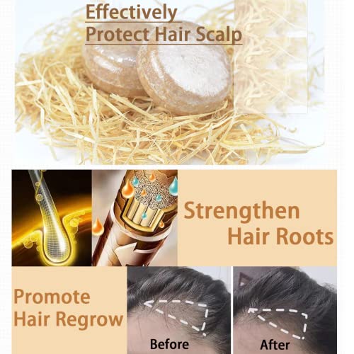 Ginger Hair Regrowth Shampoo Bar,Ginger Plant Shampoo Soap,Natural Organic Ginger Shampoo Bar, Anti Hair Loss, Anti Hair Frizzing,Anti Dandruff &