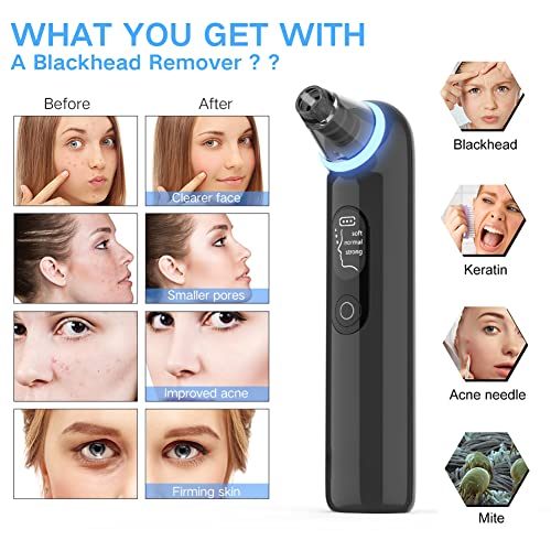 Blackhead Removers Vacuum Electric Blackhead Remover Pore Vacuum, 3 Levels and 4 Suction Heads Black Head Vacuum Remove Kit with Blue Light, Pore