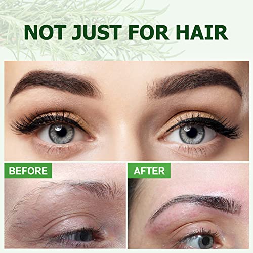 Find Back Rosemary Essential Oil Hair Growth & Skin Care, Improve Hair Loss and Nourishes Scalp and Wo, Rosemary Oil Hair Growth, Hair Growth Oil