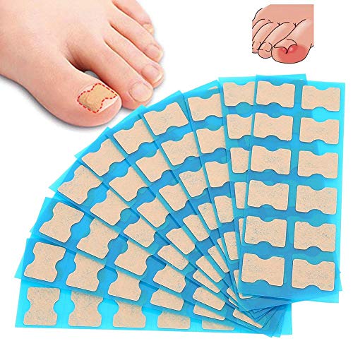 Ingrown Toenail Stick Patch, 4 Sizes Glue-free Toe Nail Correction File Patch Paronychia Corrector Foot Care Treatment Pedicure Tool Ingrown Toen