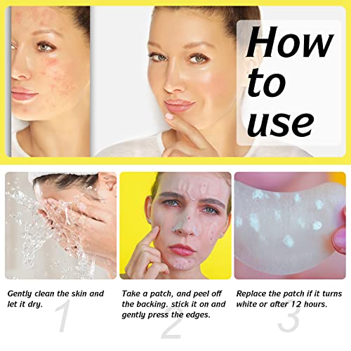 Hydrocolloid Acne Patch, Large Pimple Patch Spot Control Cover, Acne Patch for Covering Large Breakouts, Spot Patch, Pimple Stickers for Body, Ch