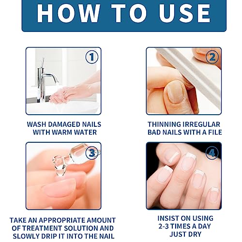 Fungal Nail Treatment for Toenails Extra Strong,50ML Nail Fungus Treatment for Toenail,Ingrown Toenail Fungus Treatment,Anti Severe Fungal Nail T