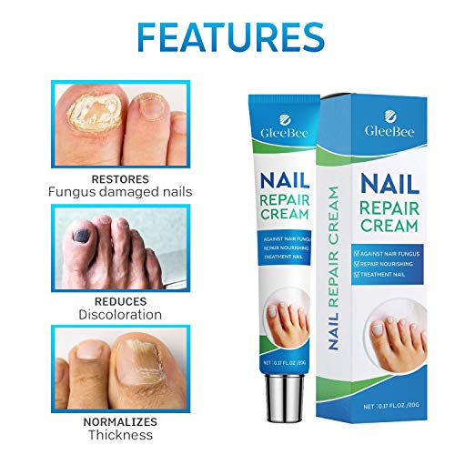 Fungal Nail Treatment, Fungus Nail Cream, Strong Anti-Fungal Toenail Cream, Nail Repair Nourishing Treatment, Restores Discolored and Damaged Nai