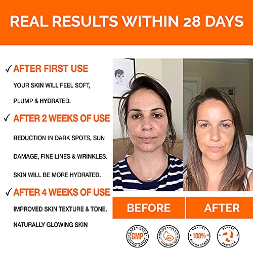 π£π₯ππ ππ¨π Vitamin C Serum For Face with Hyaluronic Acid Serum - Anti Ageing & Anti Wrinkle Serum - Customers Call It A Face Lift without the needle