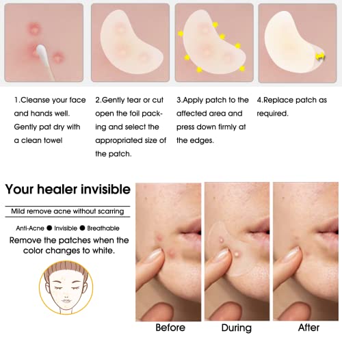 Hydrocolloid Acne Patch(20 Patches), Large Pimple Patch Spot Control Cover, Extra Larger Acne Patch for Covering Large Breakouts, Spot Patch, Pim