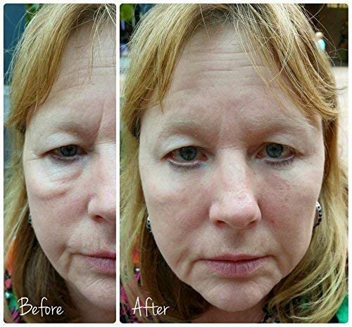 Jeunesse Instantly Ageless 10 Vial - Immediately reduces the appearance of under-eye bags, fine lines, wrinkles and pores, and lasts 6 to 9 hours