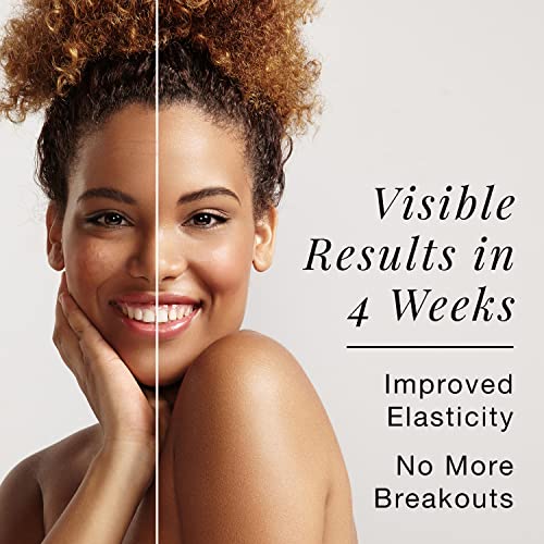 60 ml Peptide Serum & Collagen Booster with Hyaluronic Acid - Vegan, Cruelty Free & Organic Anti Aging Face Serum For Wrinkles, Stretch Marks & S