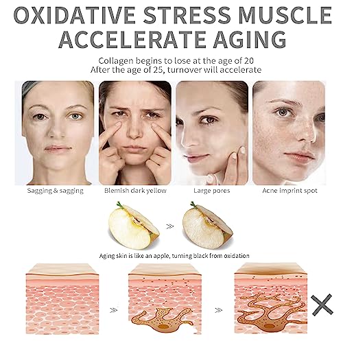 Niacinamide10%+Zinc 1%,Tackles Blemishes, Pore Reducer Face Serum,Minimises Pore, Brightening Serum for Blemish-Prone,Dull Skin, Softens & Bright