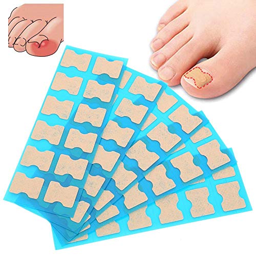Ingrown Toenail Stick Patch, 4 Sizes Glue-free Toe Nail Correction File Patch Paronychia Corrector Foot Care Treatment Pedicure Tool Ingrown Toen