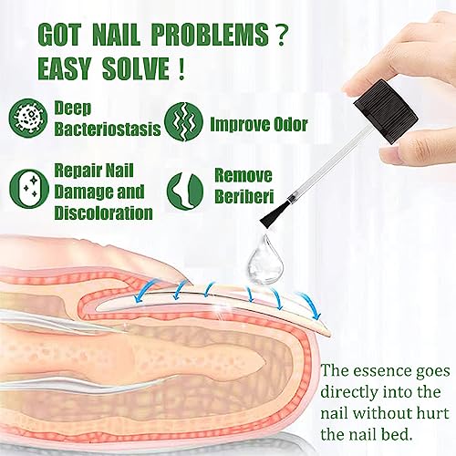 Fungal Nail Treatment, Nail Repair Kit For Broken Natural Nails, Extra Strong Fungal Nail Treatment For Toenails And Fingernail, Ingrown Toenail