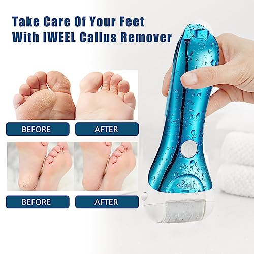 Electric Foot Callus Remover, Rechargeable Electronic Foot File Pedicure Kits, Electric Callus Remover for Feet, Foot Scrubber Dead Skin Remover,