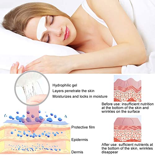 Forehead Patches for Wrinkles,Forehead Wrinkle Patches,Facial Anti-wrinkle Patches,Facial Wrinkle Patches,Facial Patches for Wrinkles,Anti-Wrinkl