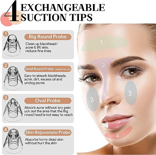 Blackhead Removers Vacuum Electric Blackhead Remover Pore Vacuum, 3 Levels and 4 Suction Heads Black Head Vacuum Remove Kit with Blue Light, Pore