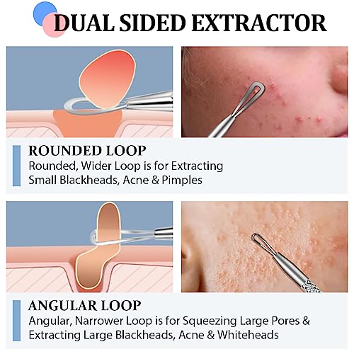 Blackhead Remover Tool Set, 6 PCS Blackhead Tweezer Comedone Extractor Blackhead Removal Tool, Pimple Spot Popping Kit Stainless Steel Black Head