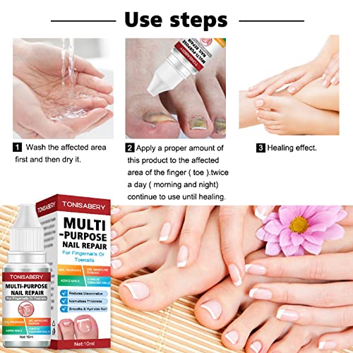 Fungal Nail Treatment,Nail Fungus Treatment For Toenail,Toe Nail Fungal Treatment,Ingrown Toenail Treatment,Toenail Fungus Treatment For Toenails