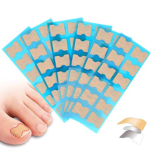 Ingrown Toenail Stick Patch, 4 Sizes Glue-free Toe Nail Correction File Patch Paronychia Corrector Foot Care Treatment Pedicure Tool Ingrown Toen