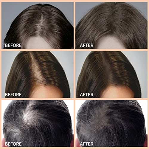 Boobeen Multi-purpose Hairline Shadow Powder Set, Root Touch Up Powder, Temporary Concealer Palette with Makeup Brush, Instantly Cover Up Hair Co