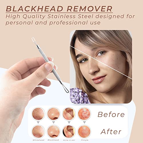 OCBA Blackhead Remover Professional Skincare Spot Treatment Blackhead Remover Tool for Blemish Comedone Whiteheads Pimple Popper with Double Side