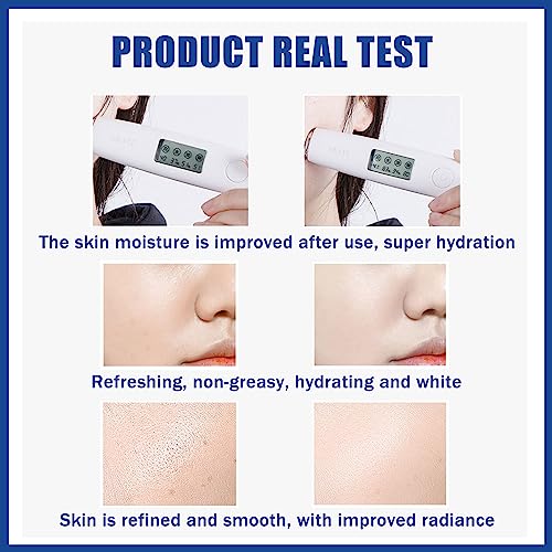 Face Moisturiser, 10% Niacinamide Serum+ 1% Zinc Serum, High-Strength Vitamin to Control Excess Oil and Redness, Tackles Blemishes, Minimises Por